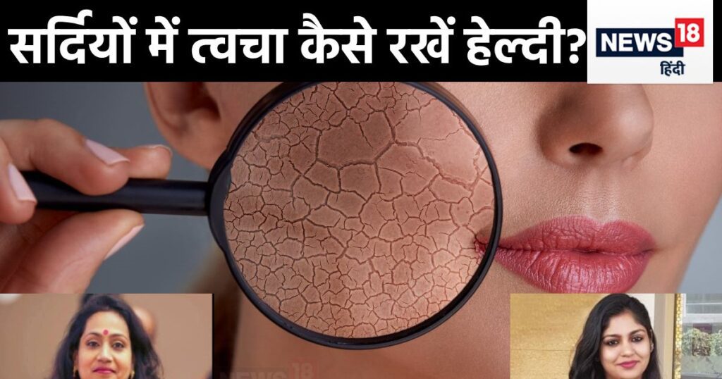 Winter Skin Care Tips 2023 11 Bb73b7086b639dc5148b028f1848b947 16x9.jpg